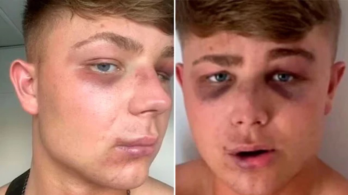 IMG 5150 | Lamianow.gr