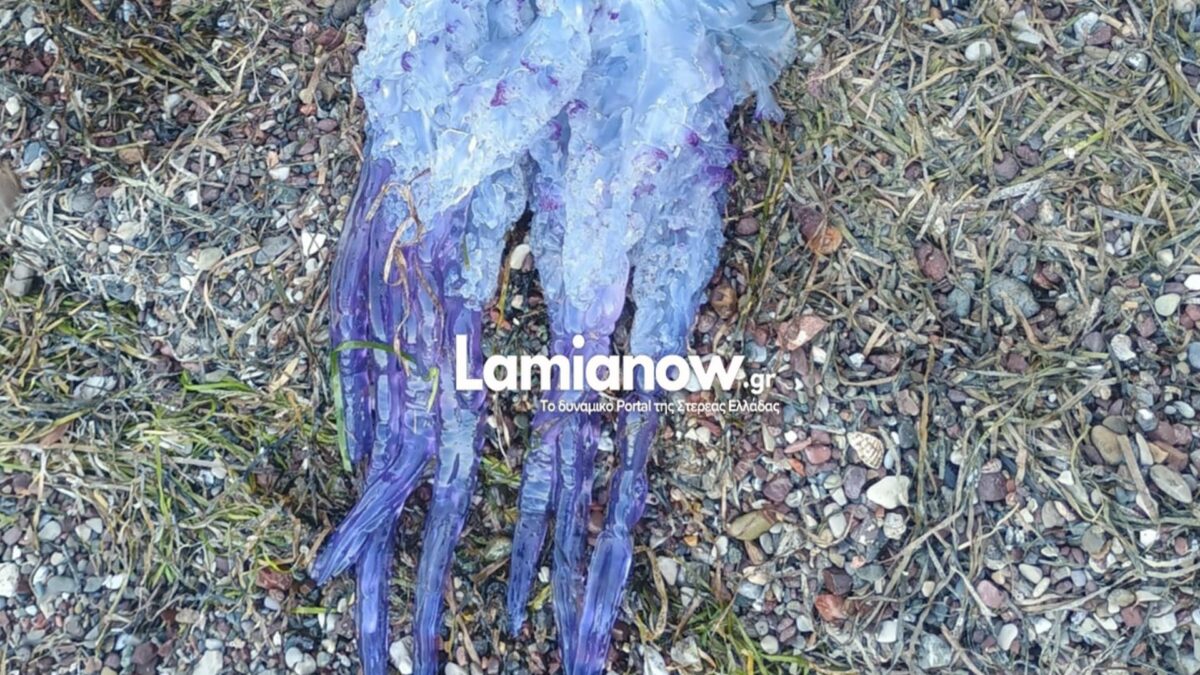 5cadfa66 dc65 4d47 a844 10d9718c90e9 | Lamianow.gr